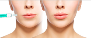 Dermal Filler Foundation Course