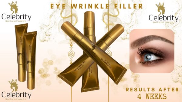 Celebrity Eye Wrinkle Filler