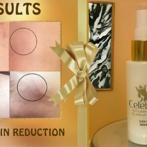 Celebrity Vein Vanish Serum