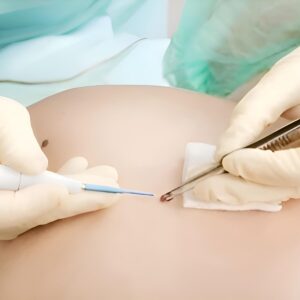 VTCT Level 4 Award in Skin Blemish Removal