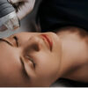 ITEC L5 Radio Frequency Microneedling Course
