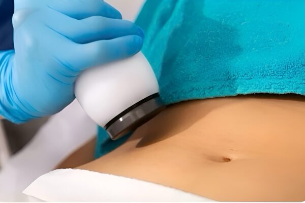 Ultrasound Cavitation & Radio Frequency Course